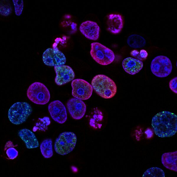 where is rna found in the cell cytoplasm