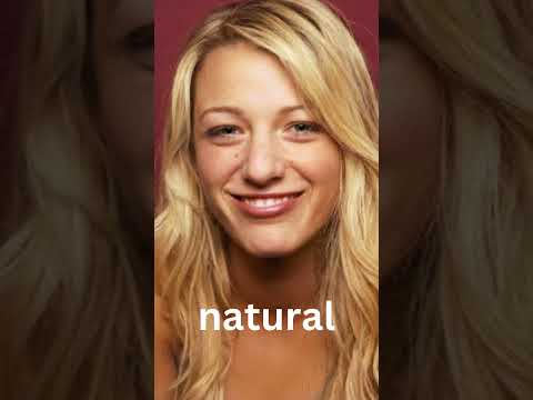 Blake Lively - 3 Nose Jobs